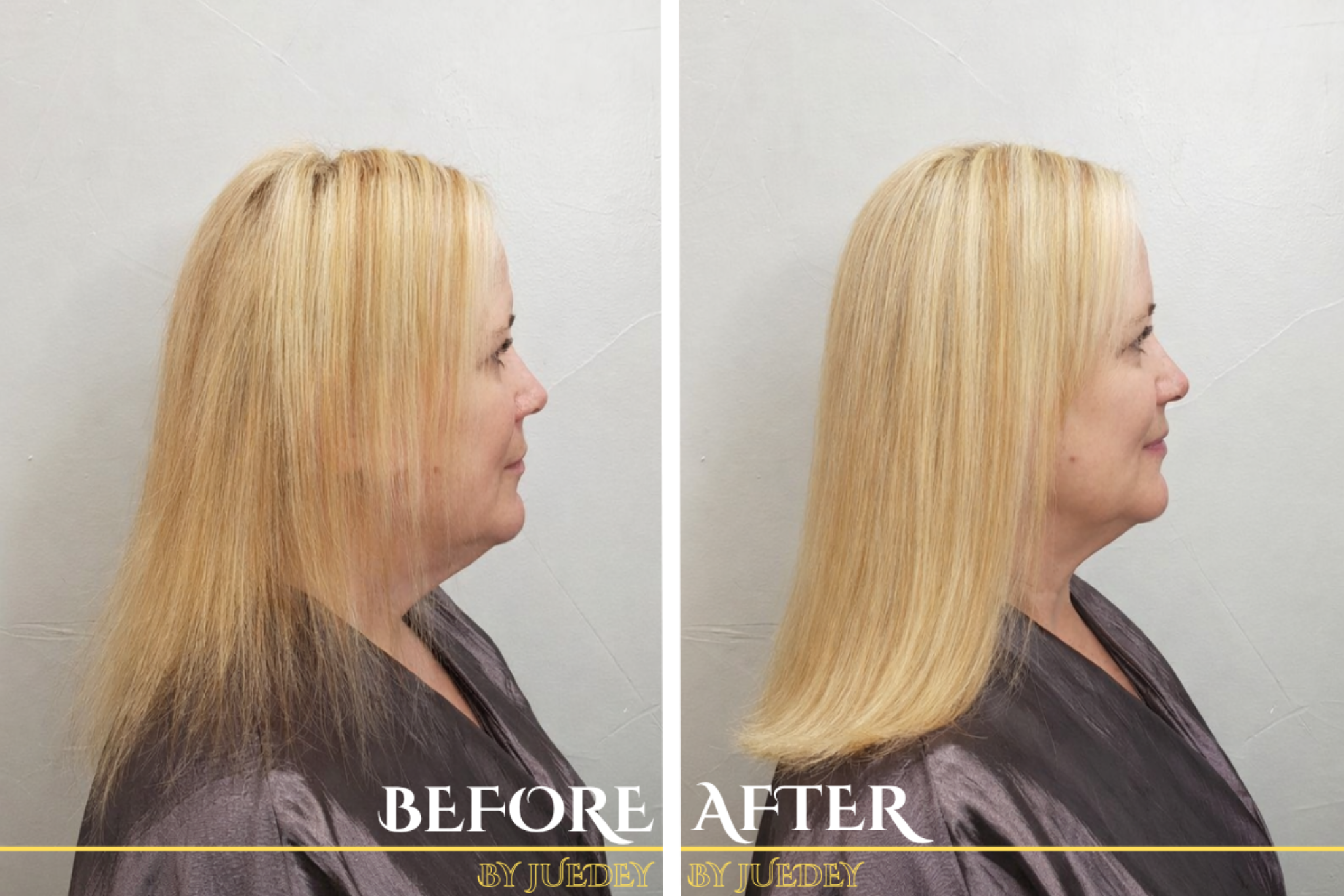 Before and after result 11